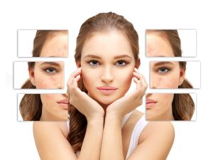 Chirurgie Esthétique