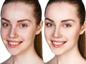 Séborégulateurs / Matifiants