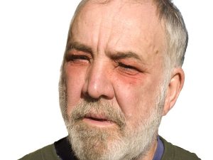 Calmants / Décongestionnants