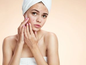 Peaux Sèches / Acné